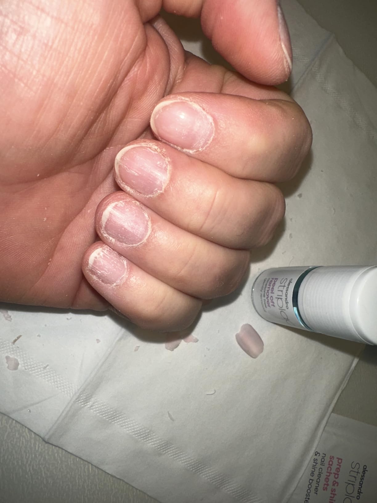 Endlich gesunde Gelnägel