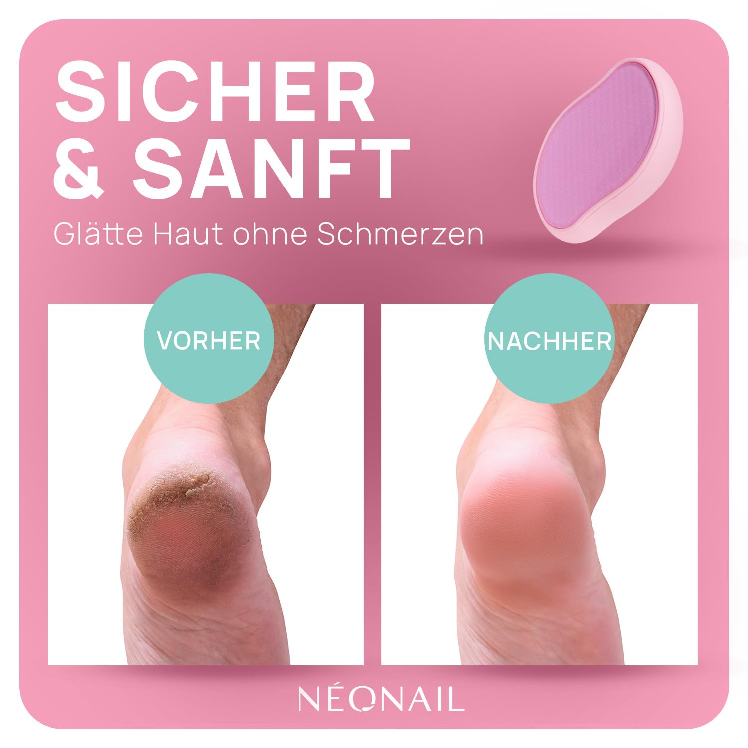 neonail-nano-glass-foot-file-hornhautentferner-glasfu-feile-f-r-trockene-nasse-a image 4