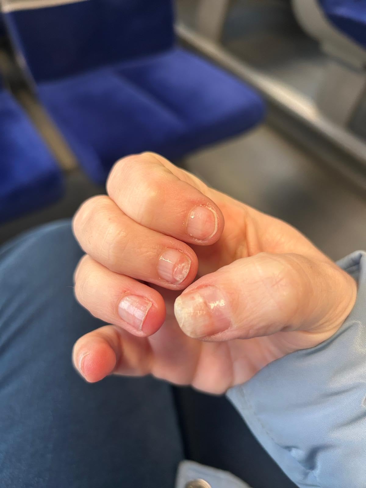 Rettung für meine Nägel