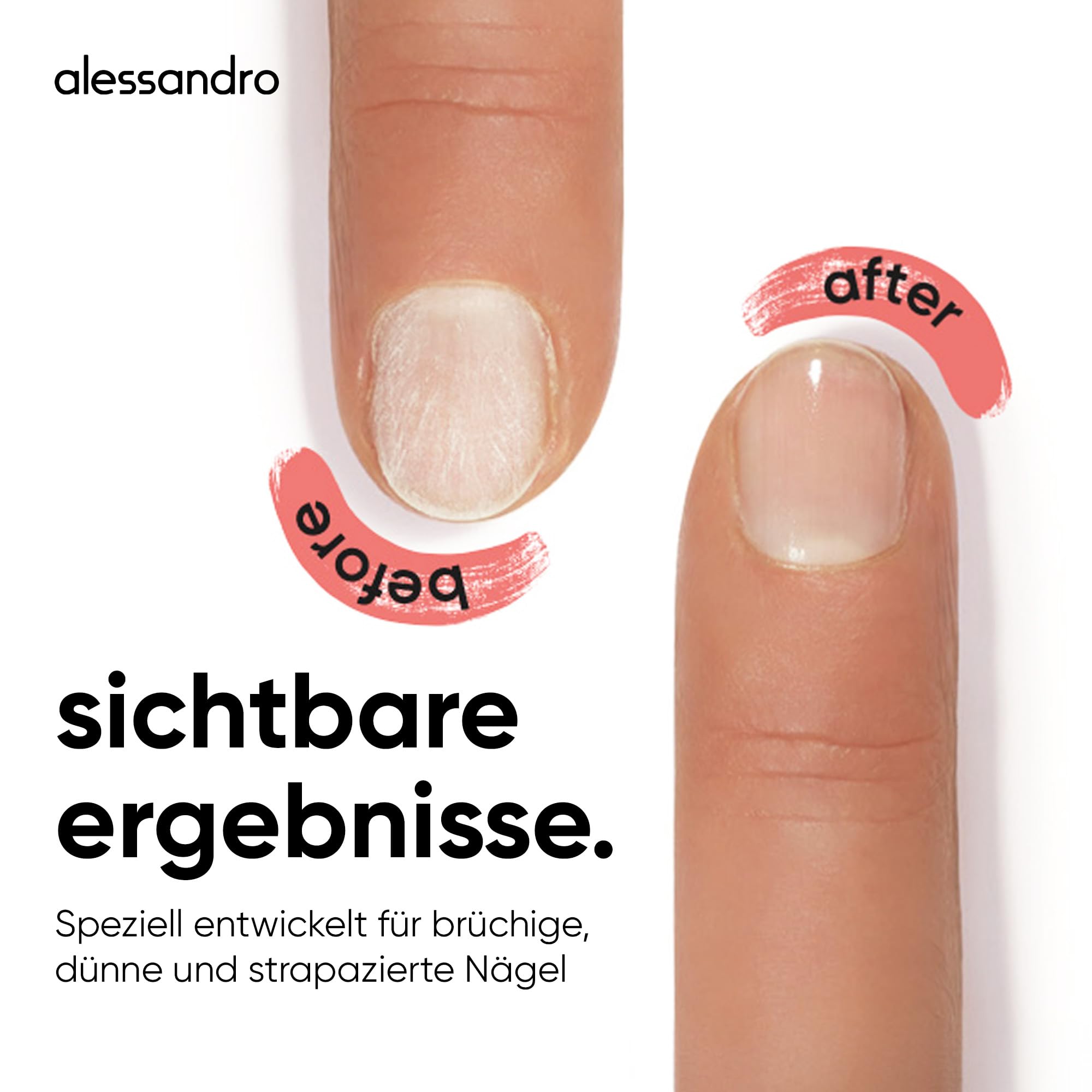 alessandro-sos-nail-repair-serum-10-ml-nagelserum-f-r-br-chige-n-gel-mit-biotin- image 4